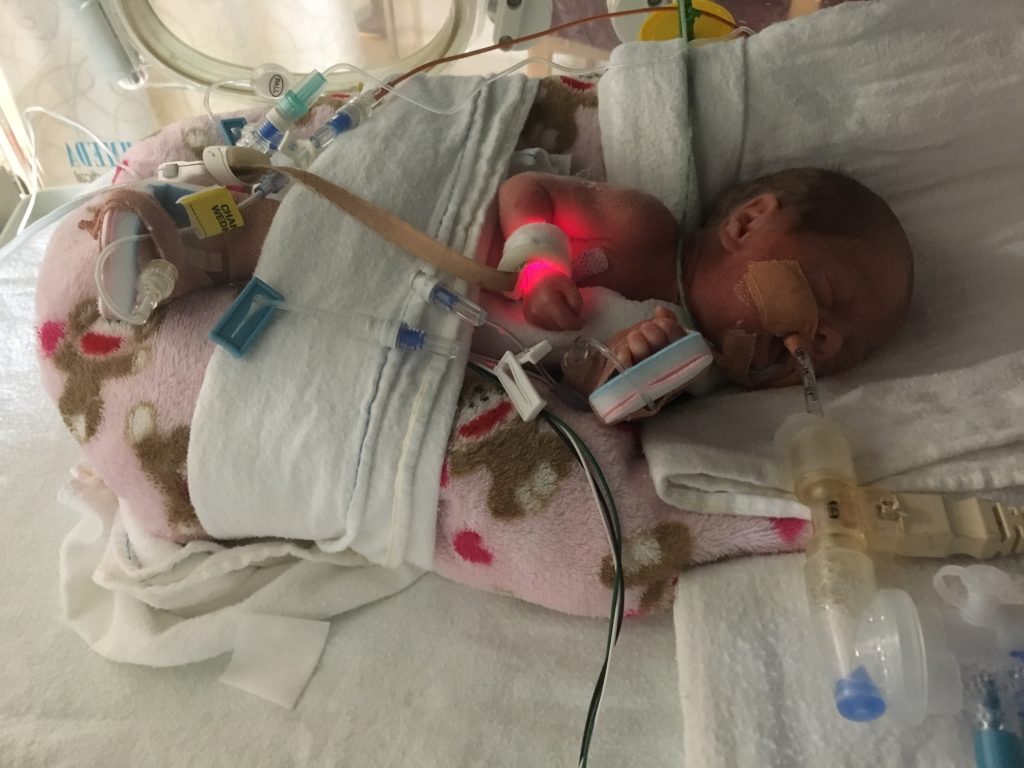 Premature Babies Victorian Infant Collaborative Study Premature Babies Victorian Infant Collaborative Study